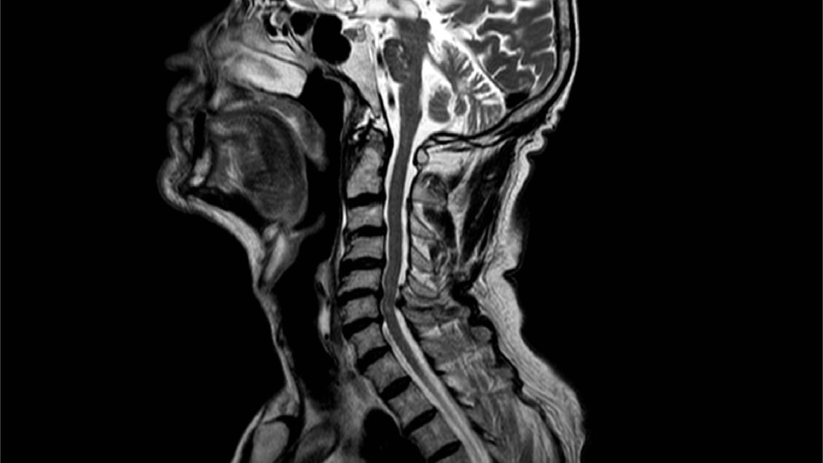 Neurocirugía, cirugía cerebral y de columna